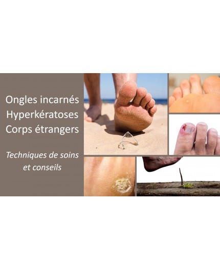 Le 15 février 2025 - Ongles incarnés, hyperkératoses et corps étrangers - Techniques de soins et conseils - Pecq